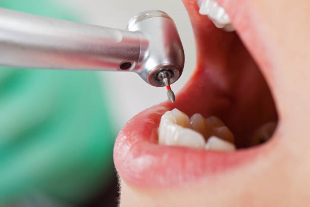 Best Emergency Care for Gum Disease in Blanco, TX